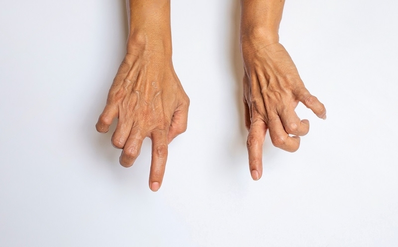 6 Possible Reasons Your Hands are Numb - Premier Neurology & Wellness Center