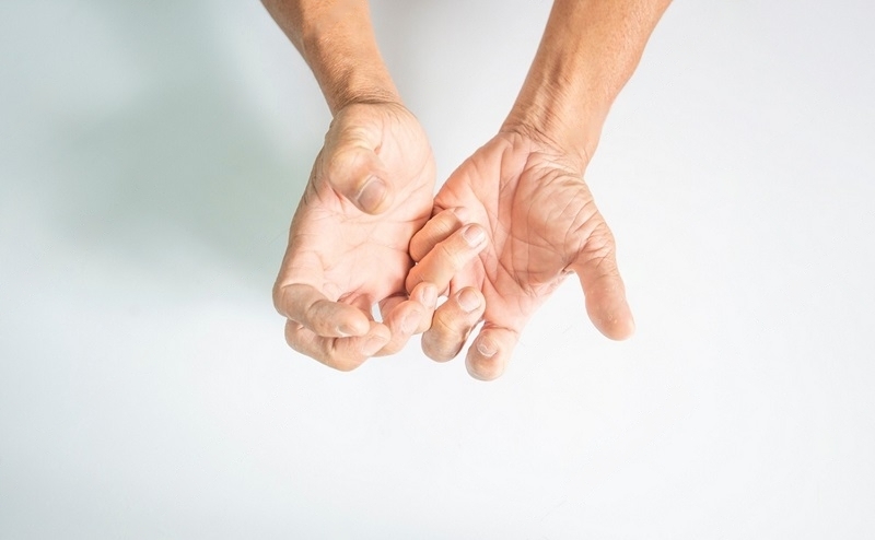 Palmaris Brevis Syndrome: A Treatable Pseudodystonia - Tremor and Other  Hyperkinetic Movements