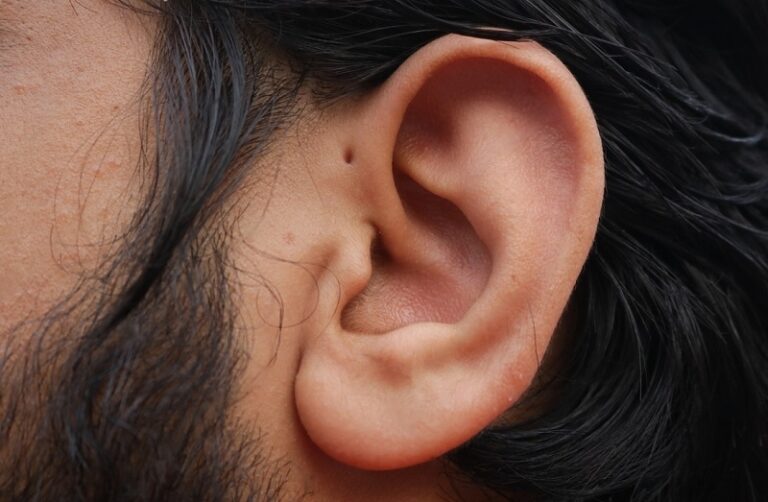 Hole in the Ear Spiritual Meaning, Preauricular Sinus in Bible