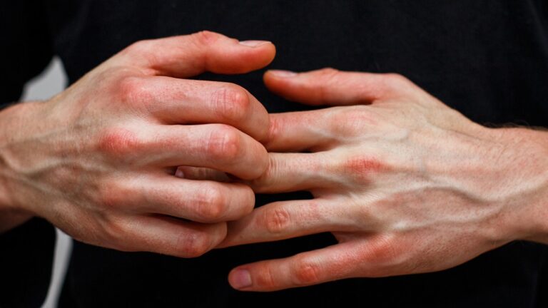 That Tingling Sensation: 12 Spiritual Meanings of Ring Finger Itching